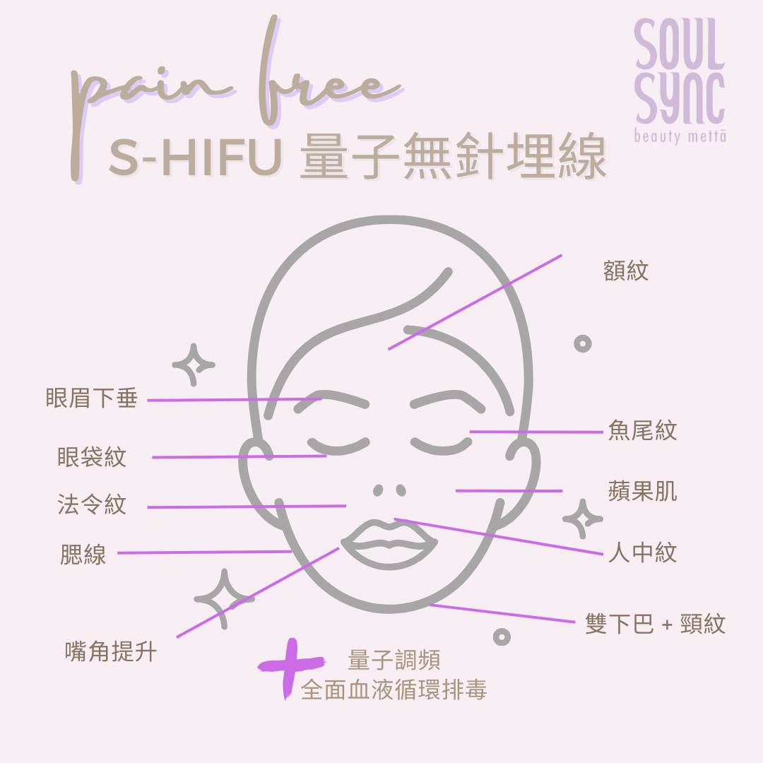 S-HIFU 量子無針埋線